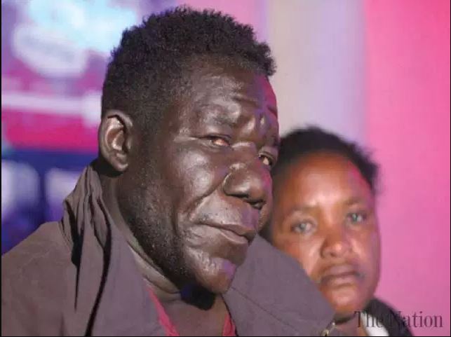 Ugliest Man In Zimbabwe