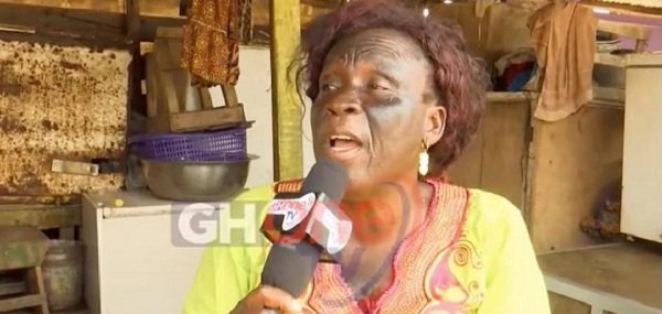 "I lost my eyes because of bleaching" - Woman shares scary experience on the effect of skin bleaching