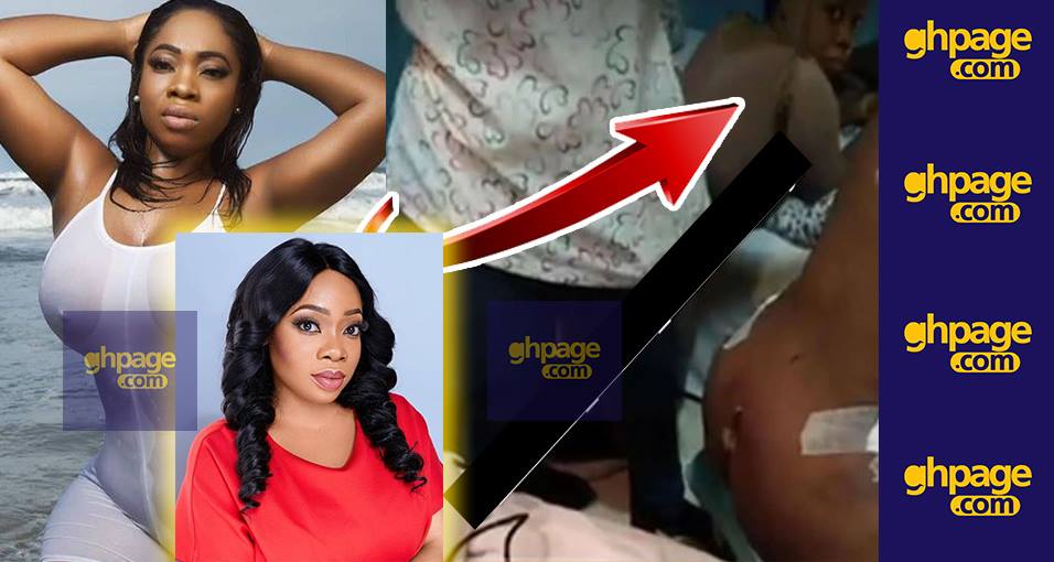 Photo Of When Moesha Boduong Was Having Her A$$ & B00bs Surgery