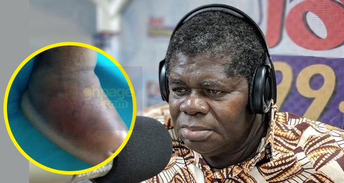 My penis is shrinking – Psalm Adjetefio begs for help