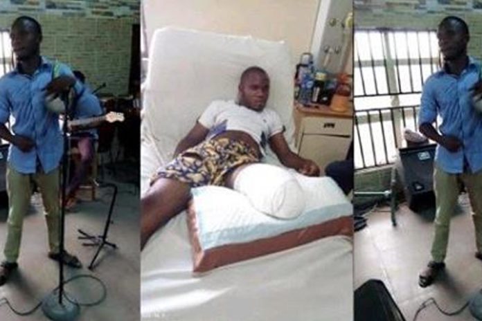 Man loses leg in an attempt to bribe a policeman