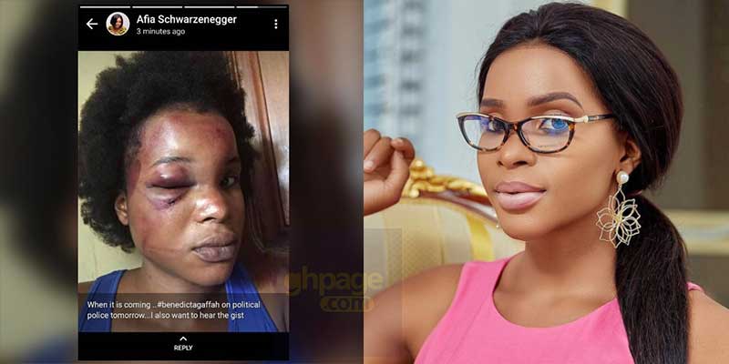 Benedicta Gafah shares photo of her brutalized face after been assaulted by a man
