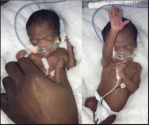 Preterm twins died in hospital because of lack of ambulance and essential amenities in Ghana - Midwife narrates