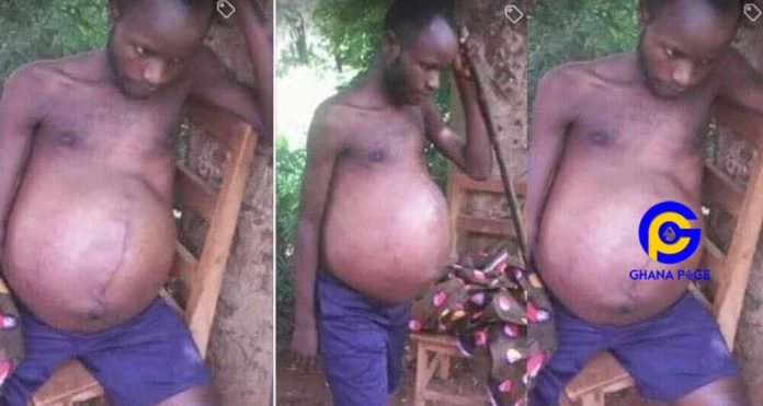 Photo of a man who got 'pregnant' after he slept with a married woman goes viral on social media