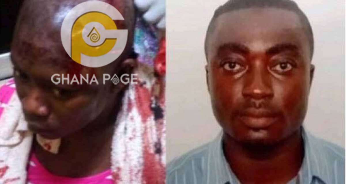 Photo: Husband stabs wife multiple times because she refused to give him money to pay a prostitute