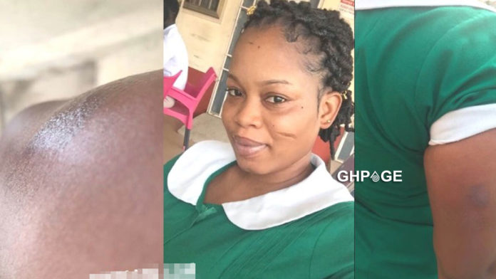 Ghanaian-nurse-assaulted-by-some-Military-men-in-Kumasi