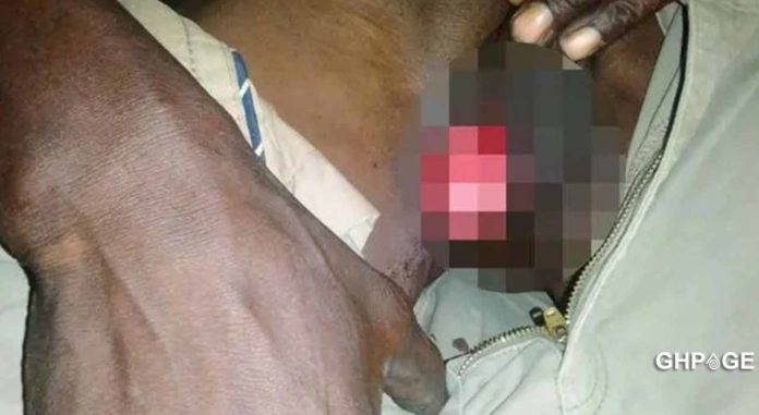 wife bites husband manhood wife bites husband manhood