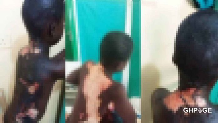 Another teenage boy sets 10-year old boy on fire with petrol in Kasoa