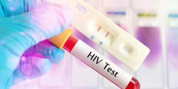 Eastern Region: Over 2,000 new HIV infections recorded
