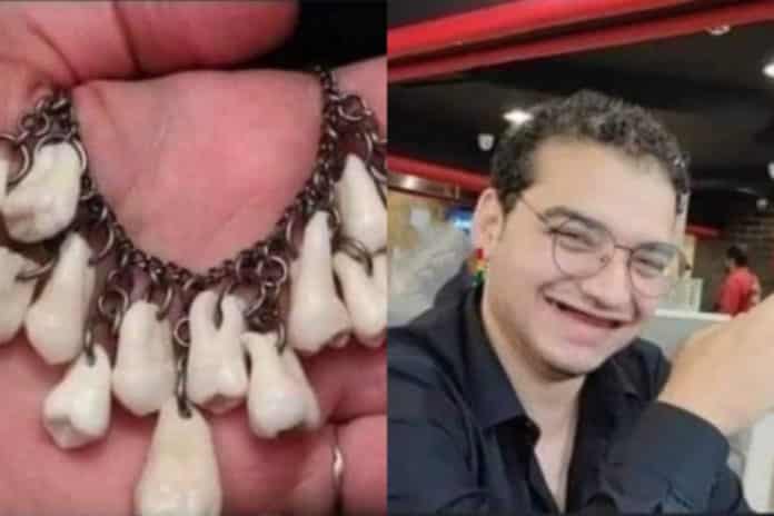 Boyfriend removes all his teeth to prove his love for the girlfriend - Photos