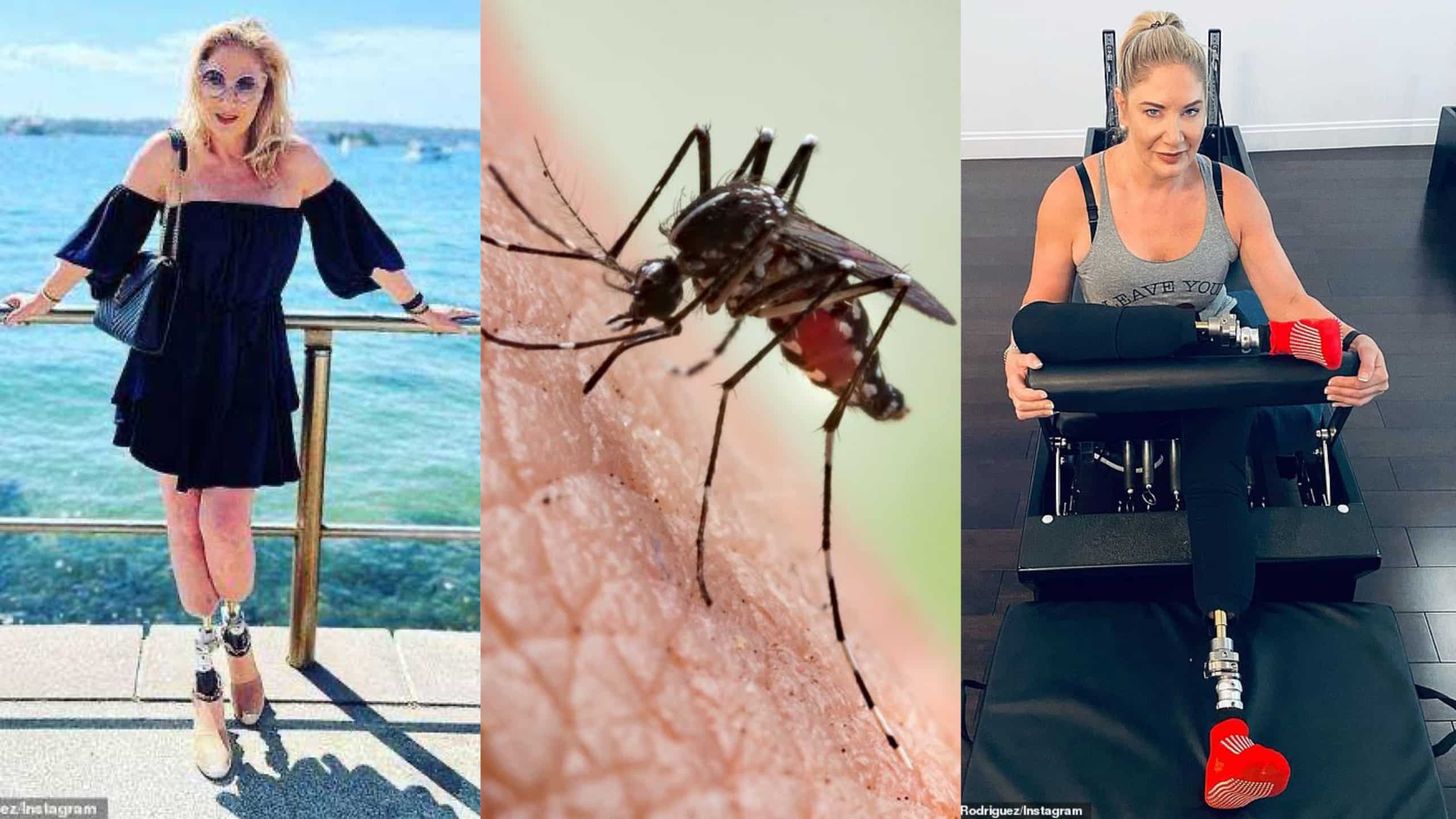 Australian socialite gets her feet amputated after a mosquito bite on her ankle in Nigeria 