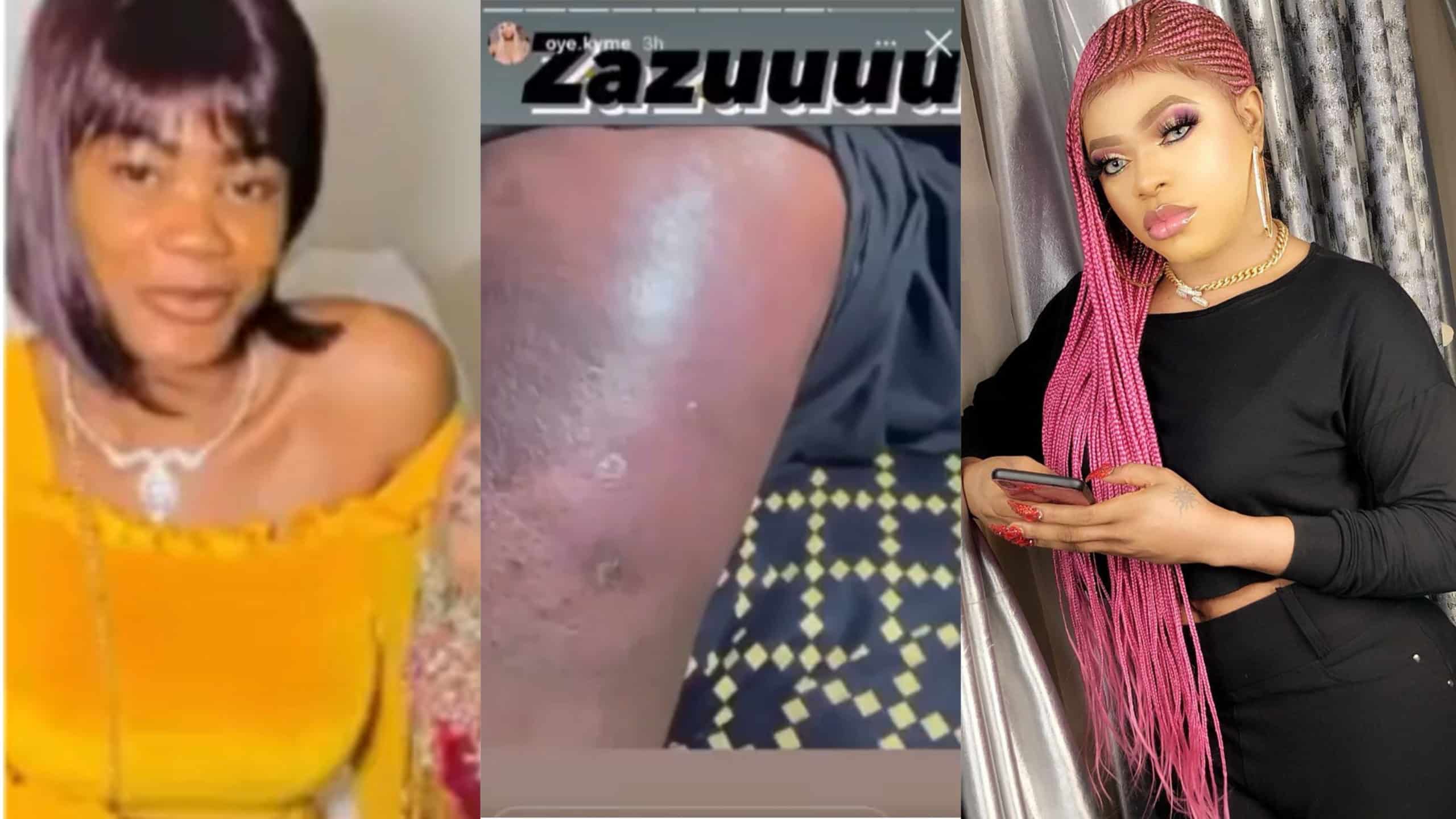 Bobrisky former P.A releases video of the alleged rotten buttocks of the cross-dresser