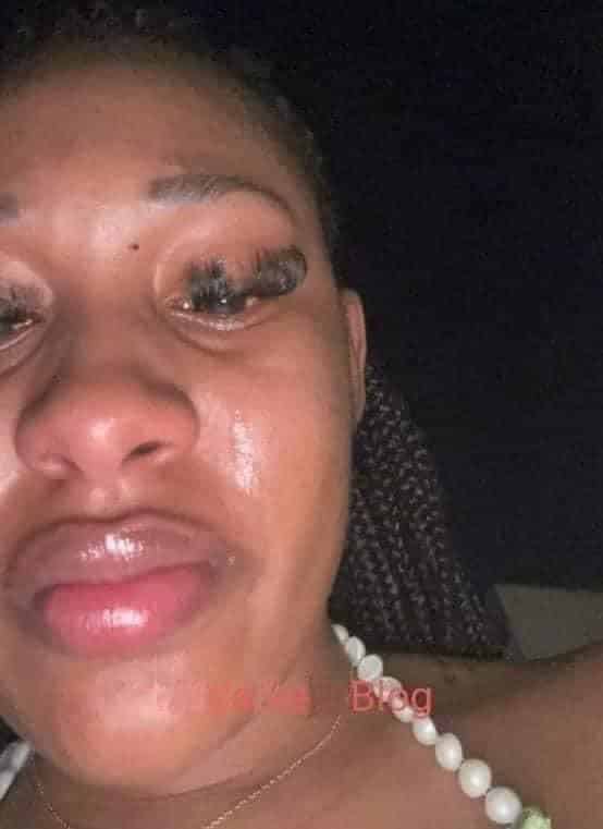 28 years old lady cries after she was beaten by her 17 years old sakawa boyfriend