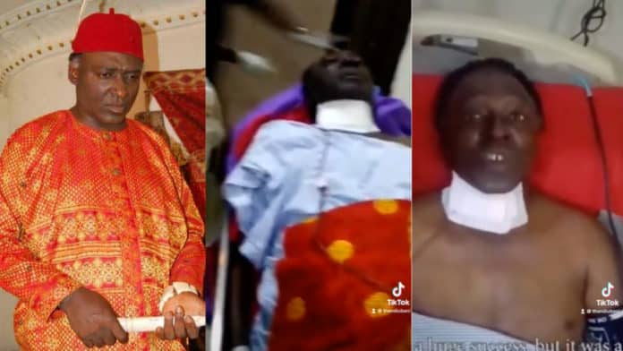 Popular Nollywood actor, Clem Ohameze survives fatal spinal cord surgery, leaves message for fans [Video]