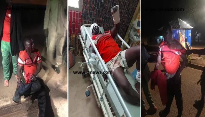 NPP executive battles for life after machete attack