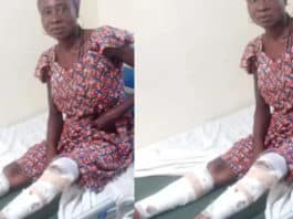 Akua Baduwa sustains cutlass wounds