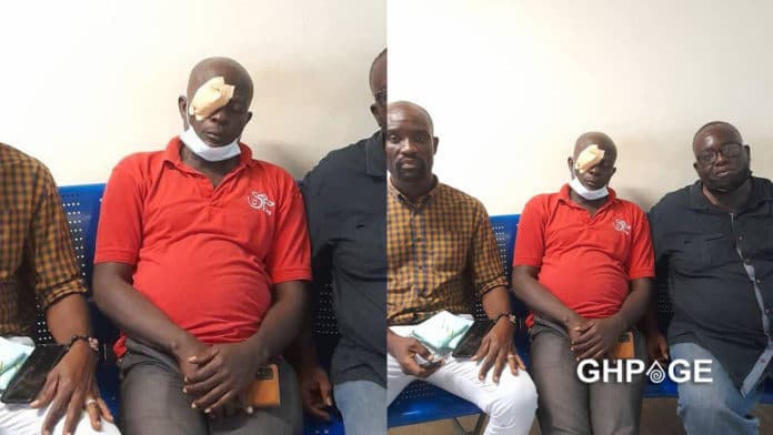 Arise Ghana protester injured in the eye-1