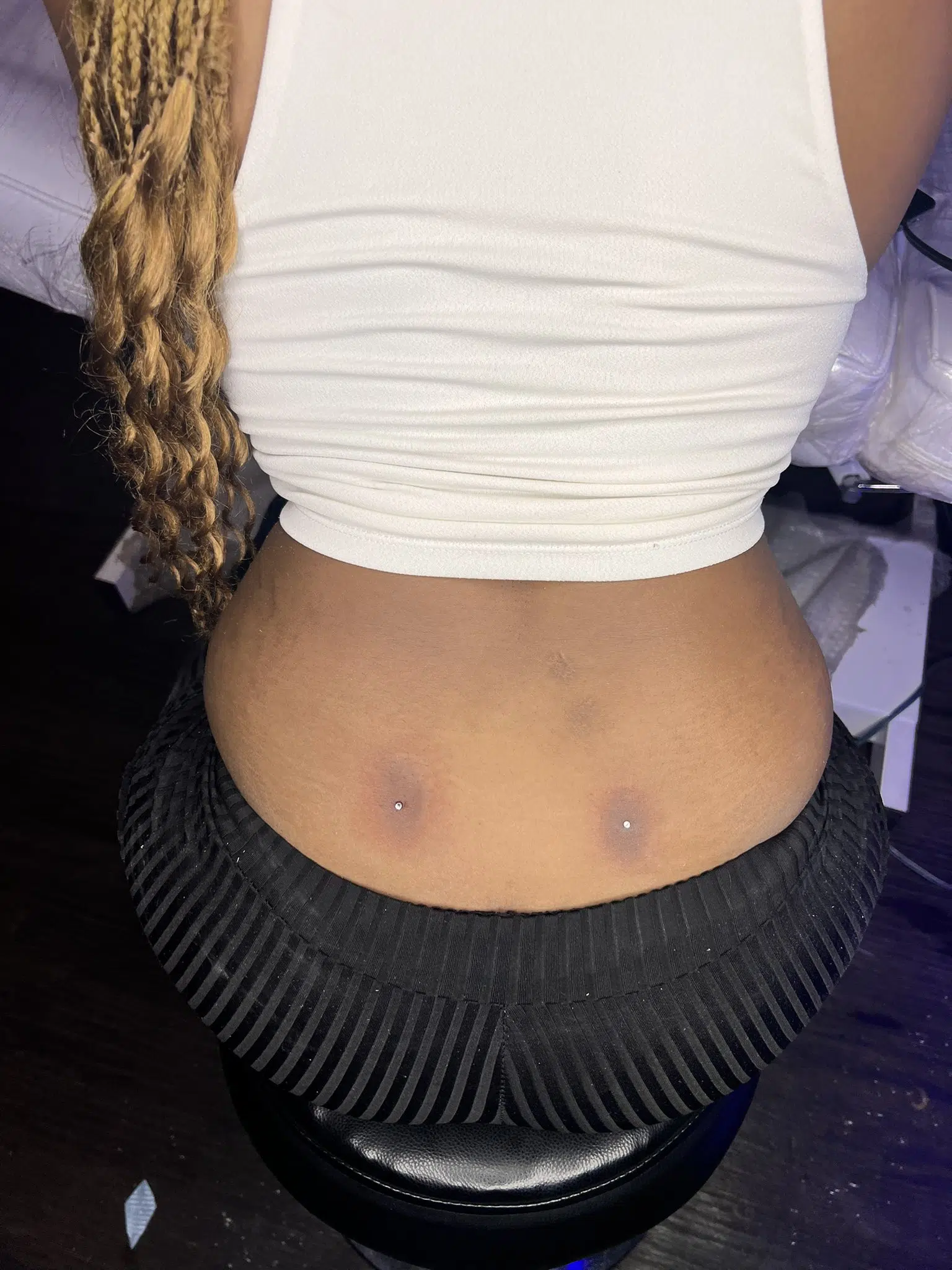 Slayqueen Hospitalized After Going For A Back Dimple Piercing Gh