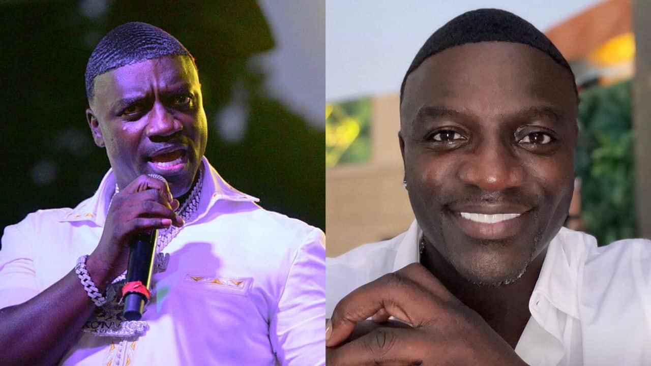 Akon spends $7500 on his new hair transplant