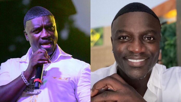 Akon spends $7500 on his new hair transplant