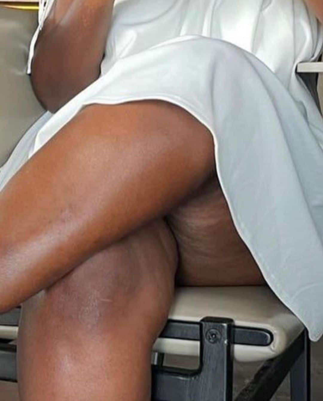 netizens troll asantewaa for flaunting her rashy thighs