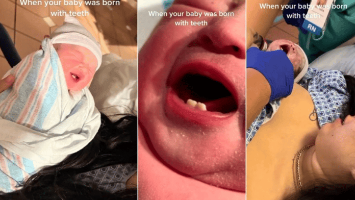 Woman gives birth to a baby with teeth