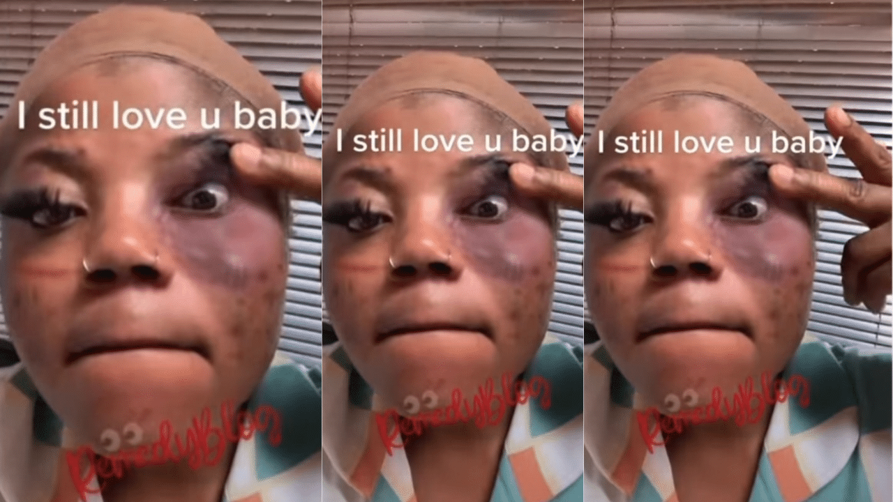 "I still love you" - Lady tells her boyfriend who brutalized and