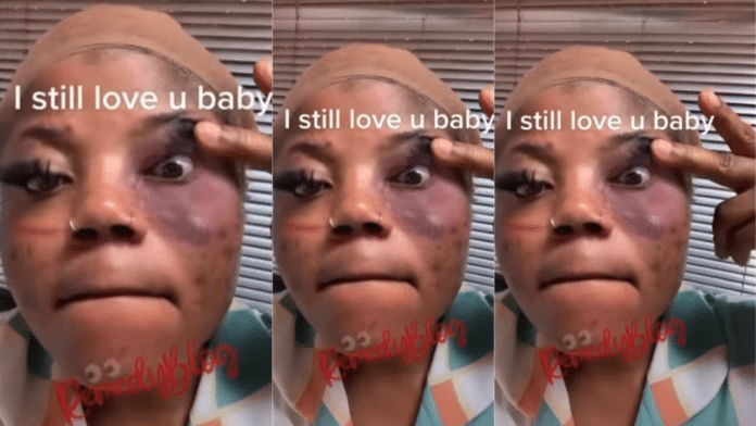 I still love you - Lady tells her boyfriend who brutalized and destroyed her face in the process