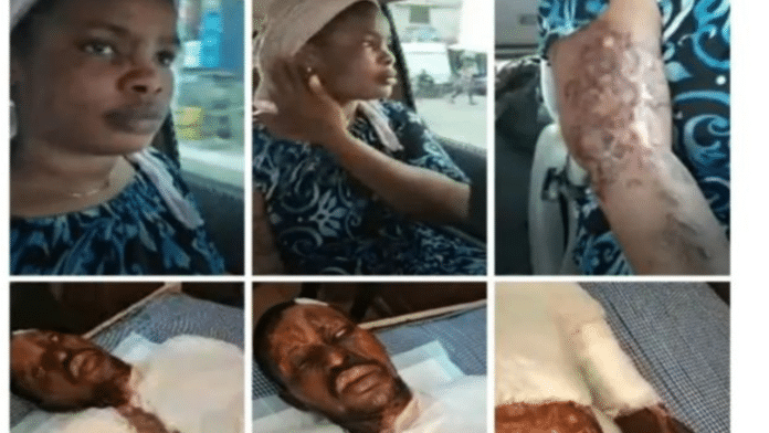 Man pours acid on his girlfriend and the guy who snatched her from him