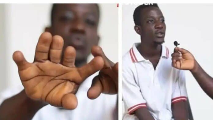 GH man with 12 fingers with manhood and vagina at the same time goes viral