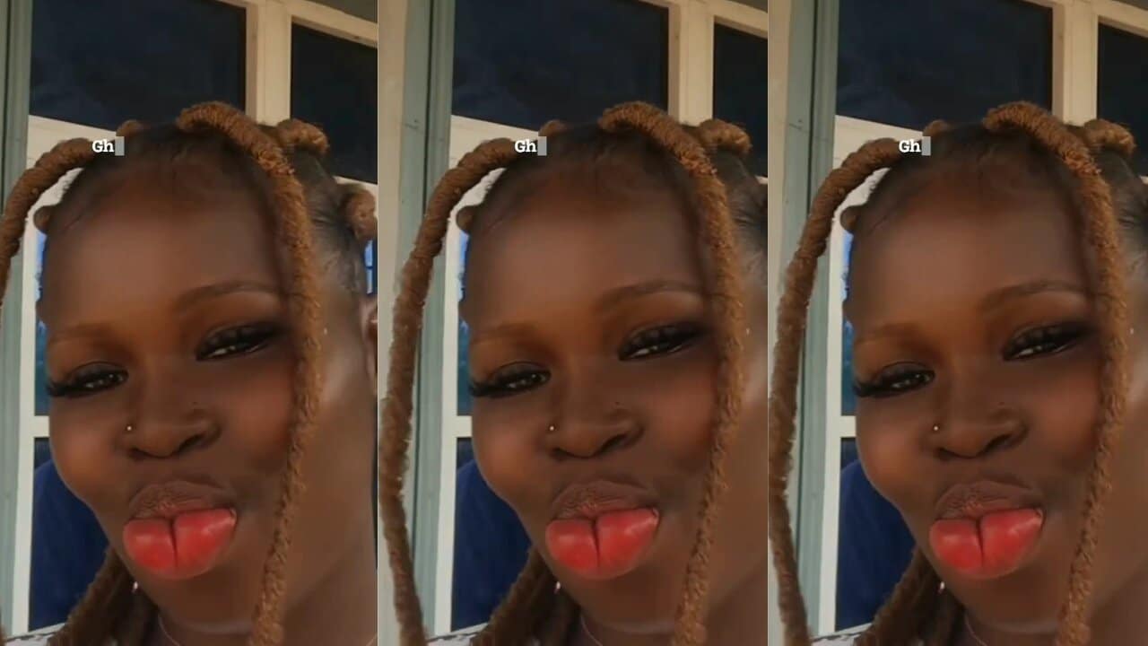 Lady happily flaunts her beautiful big reddish lips after undergoing surgery - Video
