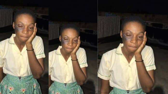Student goes partially blind as headmaster slaps her for leaving campus without an exeat
