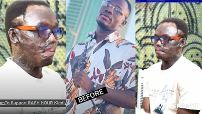 Before and after of Kofi-Poku