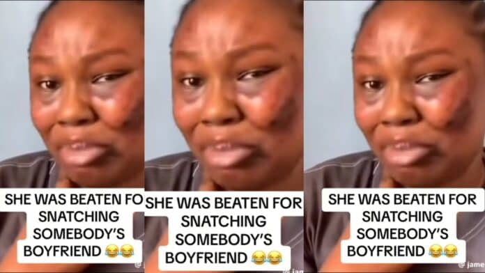 Lady shows her bruised face after receiving massive beatings from her boyfriend's main girlfriend
