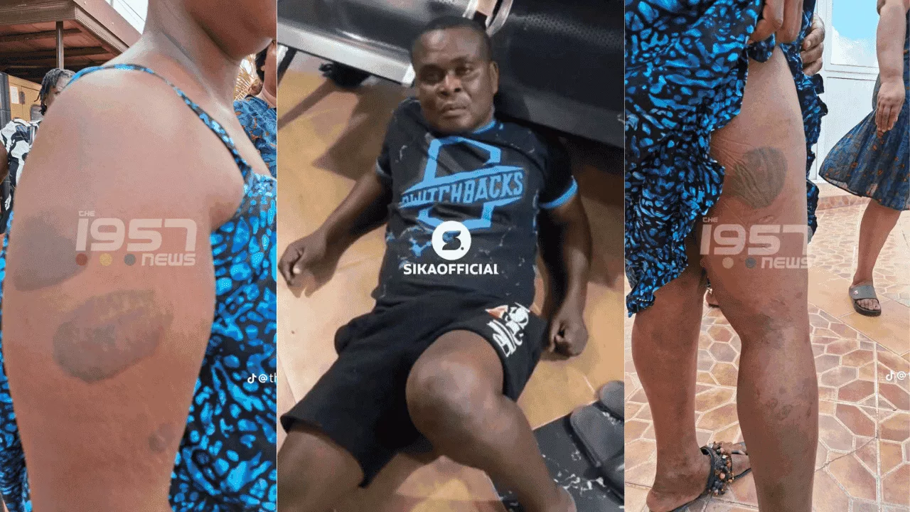 Photos of the assault marks Bra Yaw left on Harriet