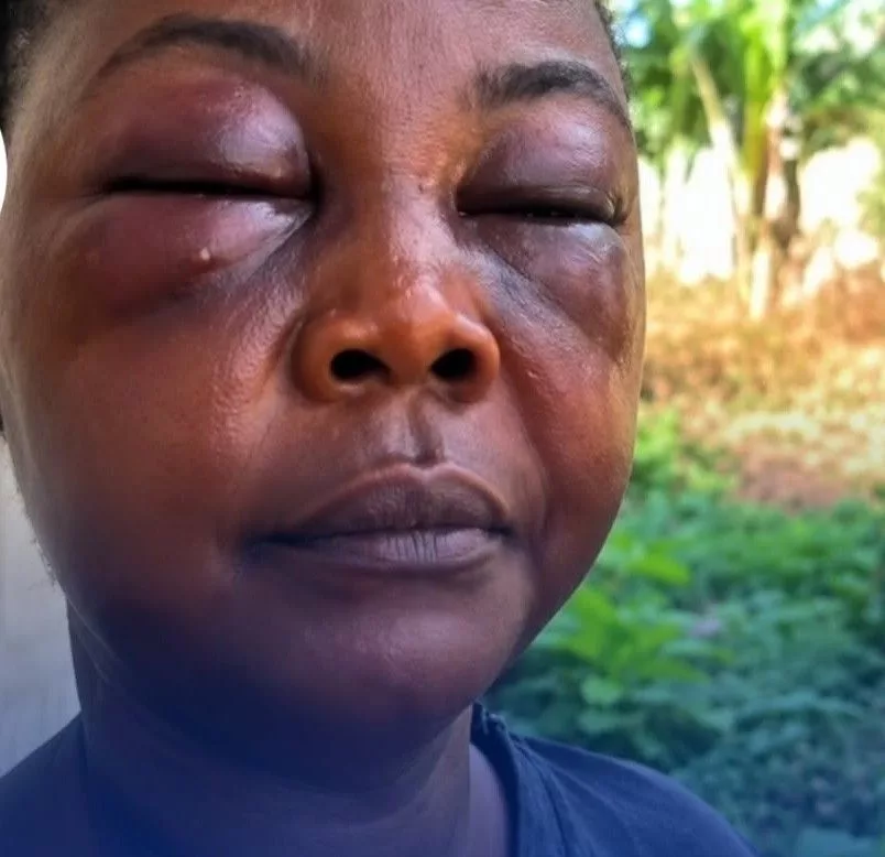 GH woman gets assaulted over a man